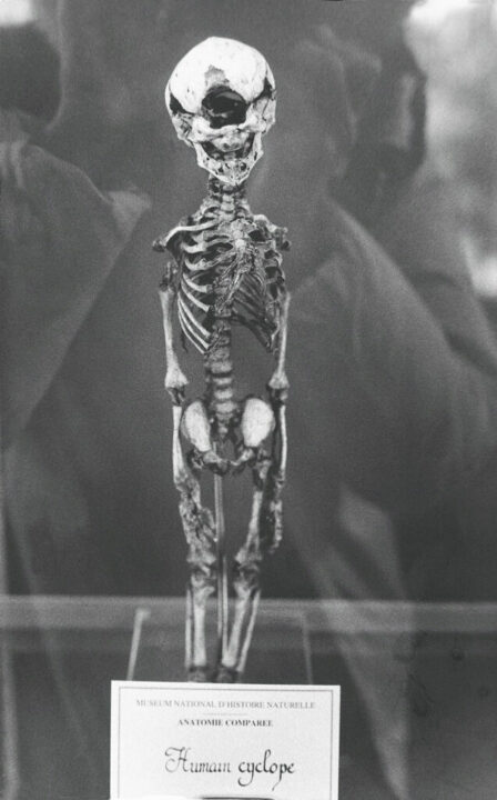 Patricia Lagarde. Cíclope humano. Sala de Anatomía Comparada del Museo Nacional de Historia Natural. París, 2002.
